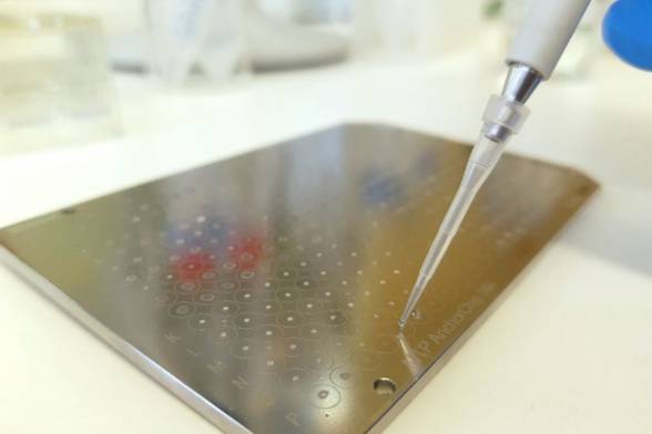 Výskum SAV približuje nádej na liečbu zriedkavej genetickej choroby