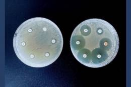 Looking for alternatives in the "post-antibiotic era"